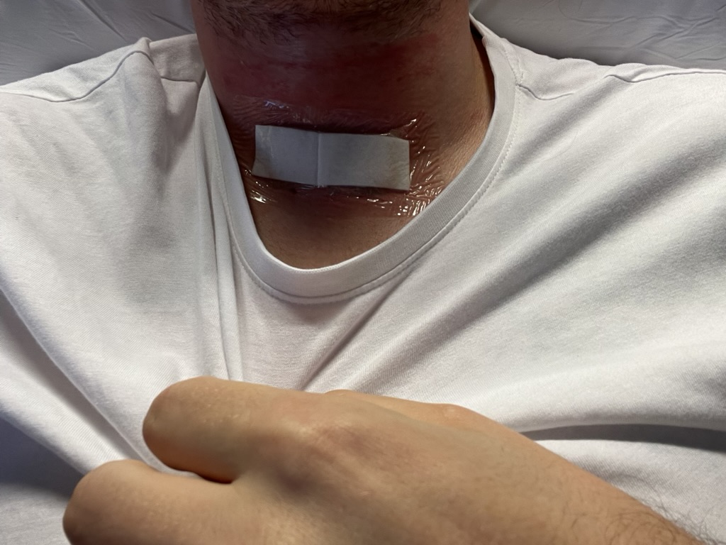 Bro where's my thyroid